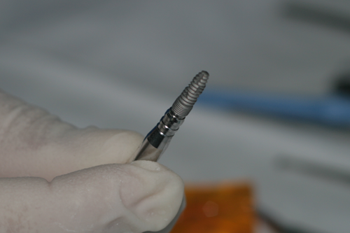 Зъбен имплантат преди поставяне